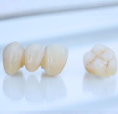 Dental Crown & Bridge