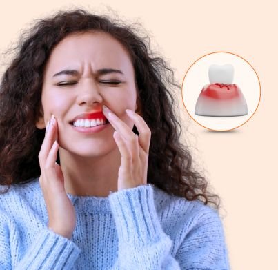 Preventive Treatment 