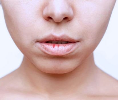  What Exactly Is Bad Breath?