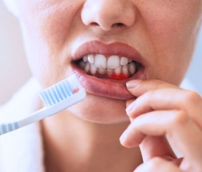 Why Does Gum Health Matter?